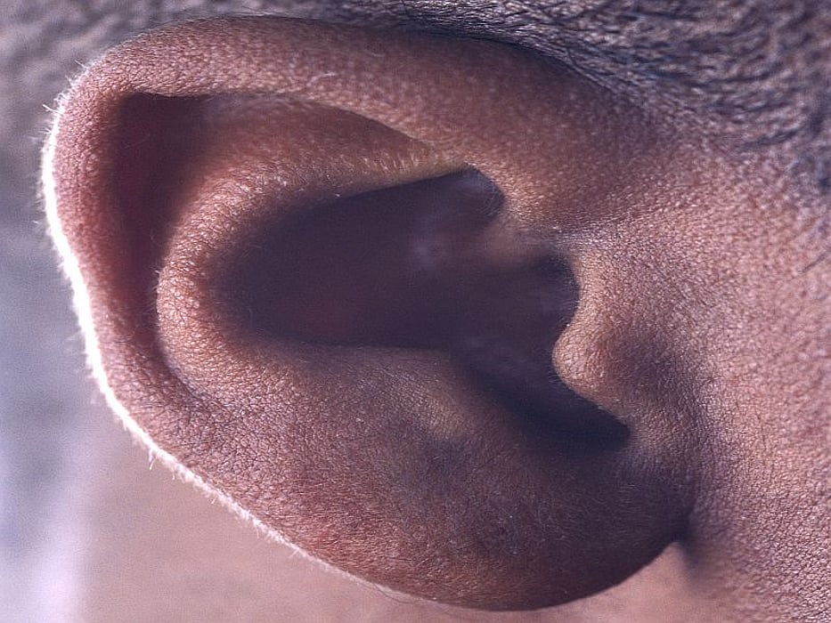 ear
