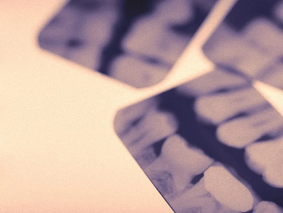 dental xrays
