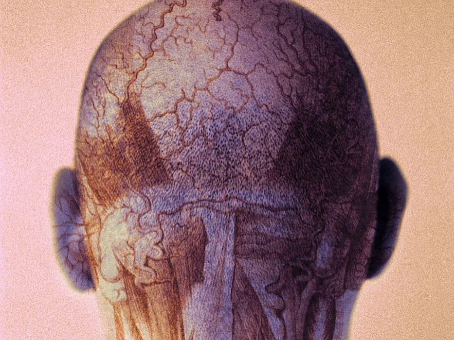 human head