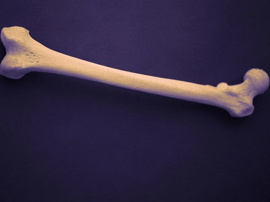 human bone