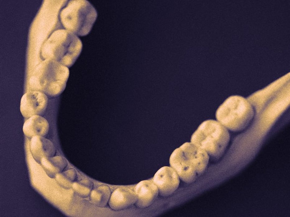 human jaw and teeth