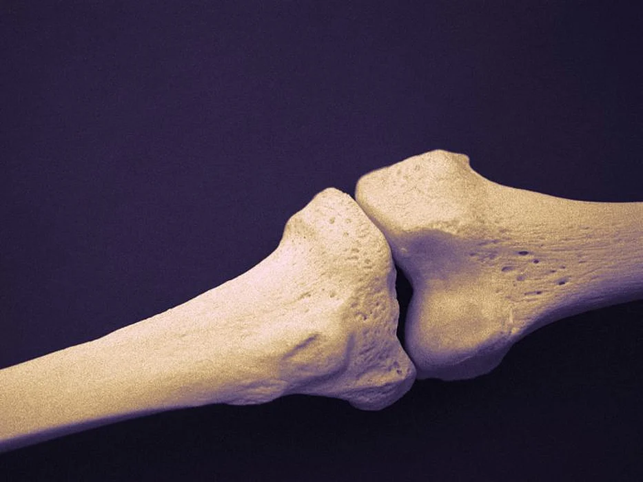 bones
