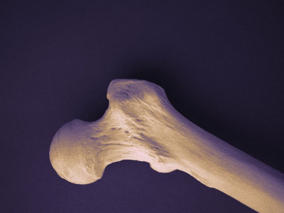 human bone