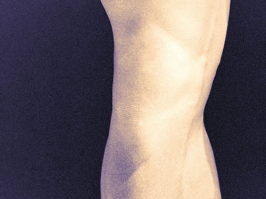 leg