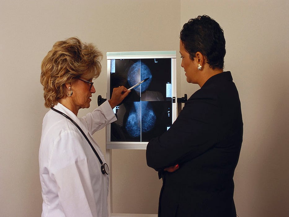 breast xray