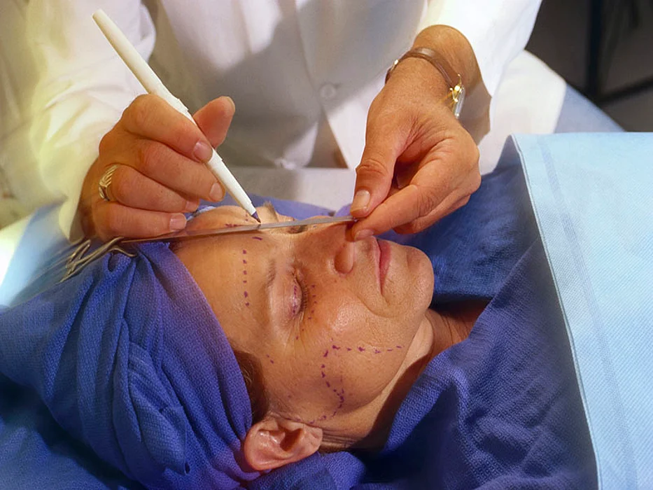 cosmetic surgery