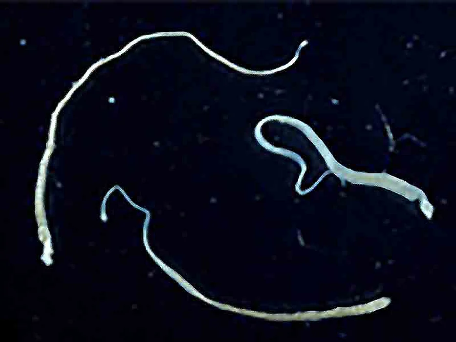 hymenolepis tapeworm