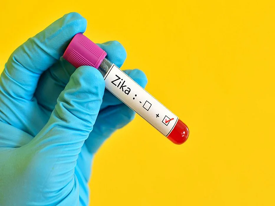 zika virus