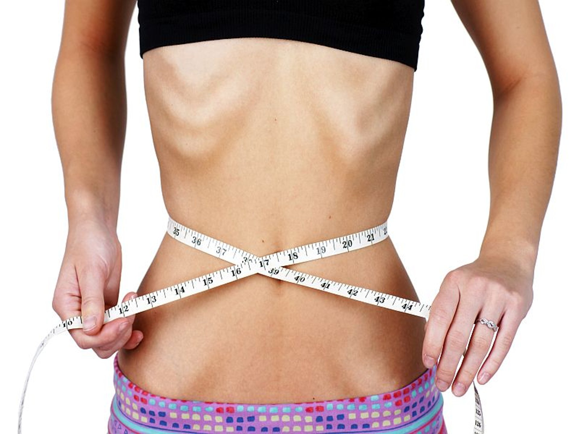 News Picture: Do Gut Microbes Play a Role in Anorexia?