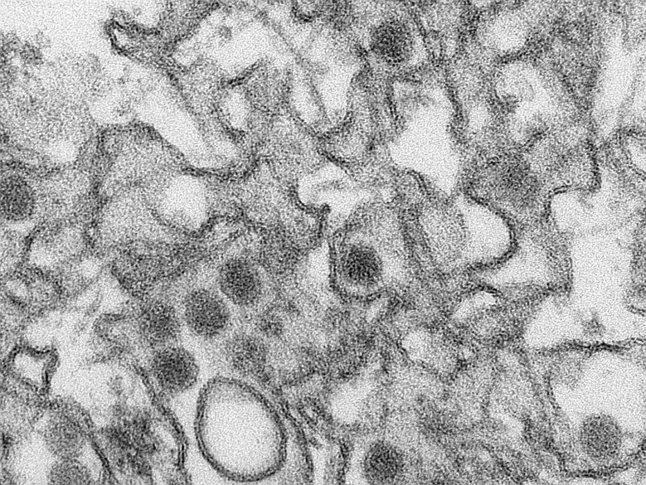 magnified zika virus