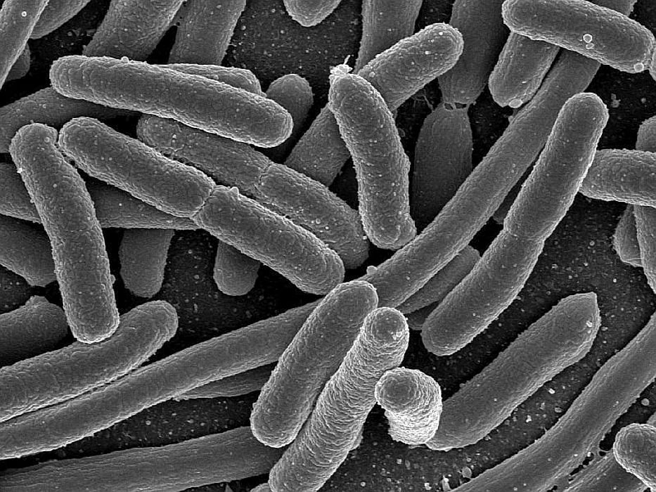 E. coli
