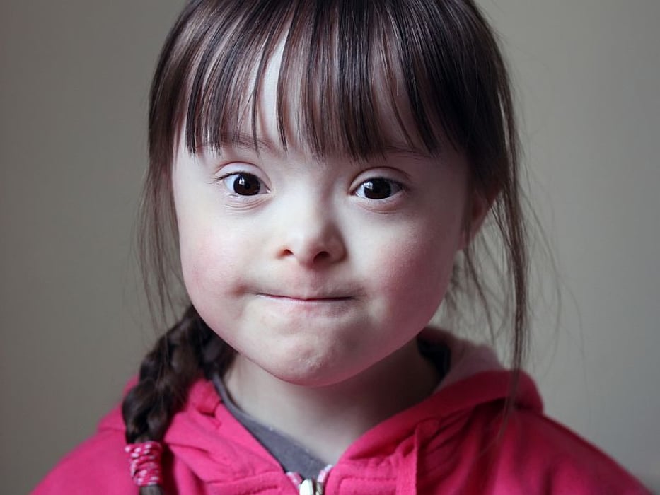 Girl with Down syndrome