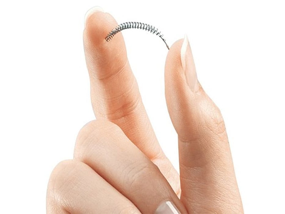 essure