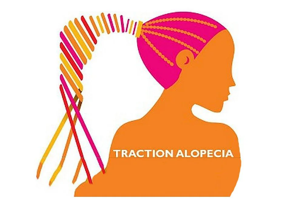 alopecia