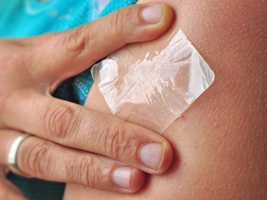 skin patch
