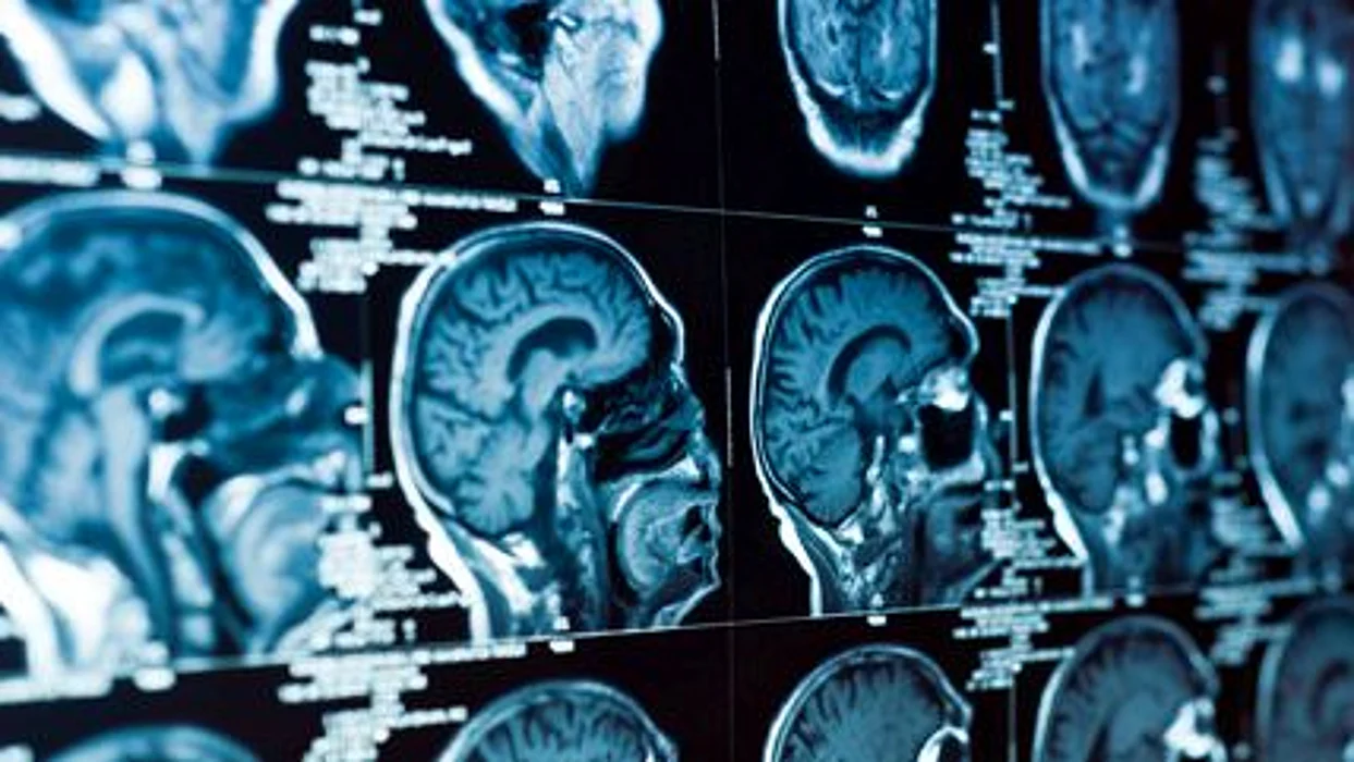 concussion concerns