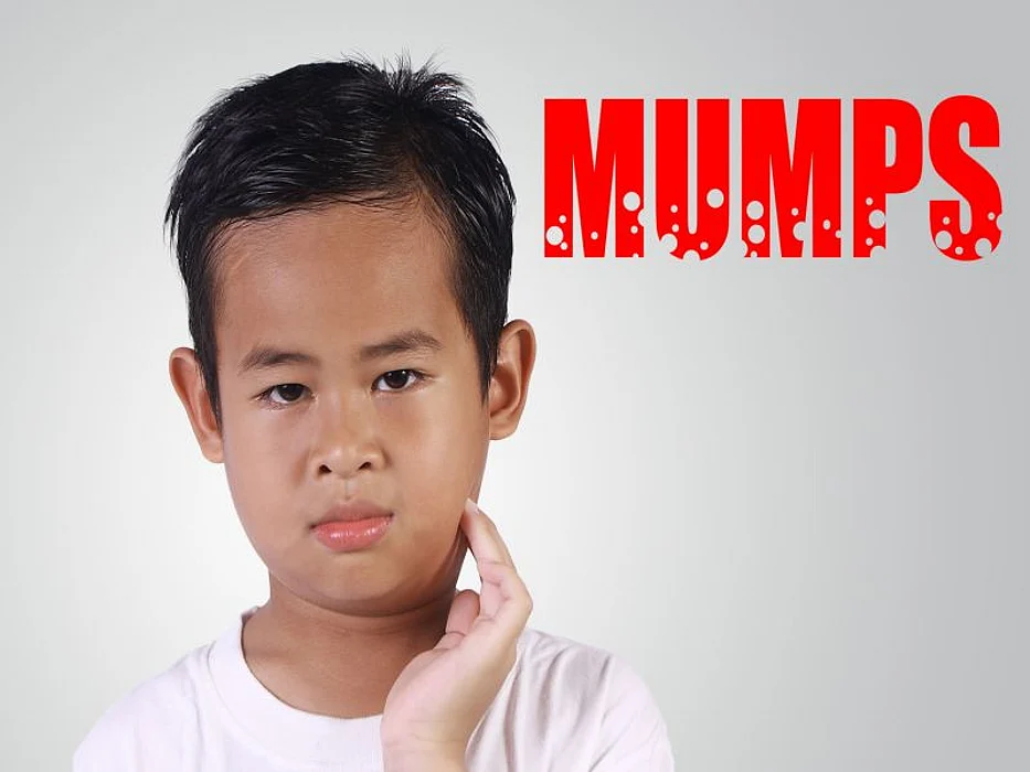 mumps