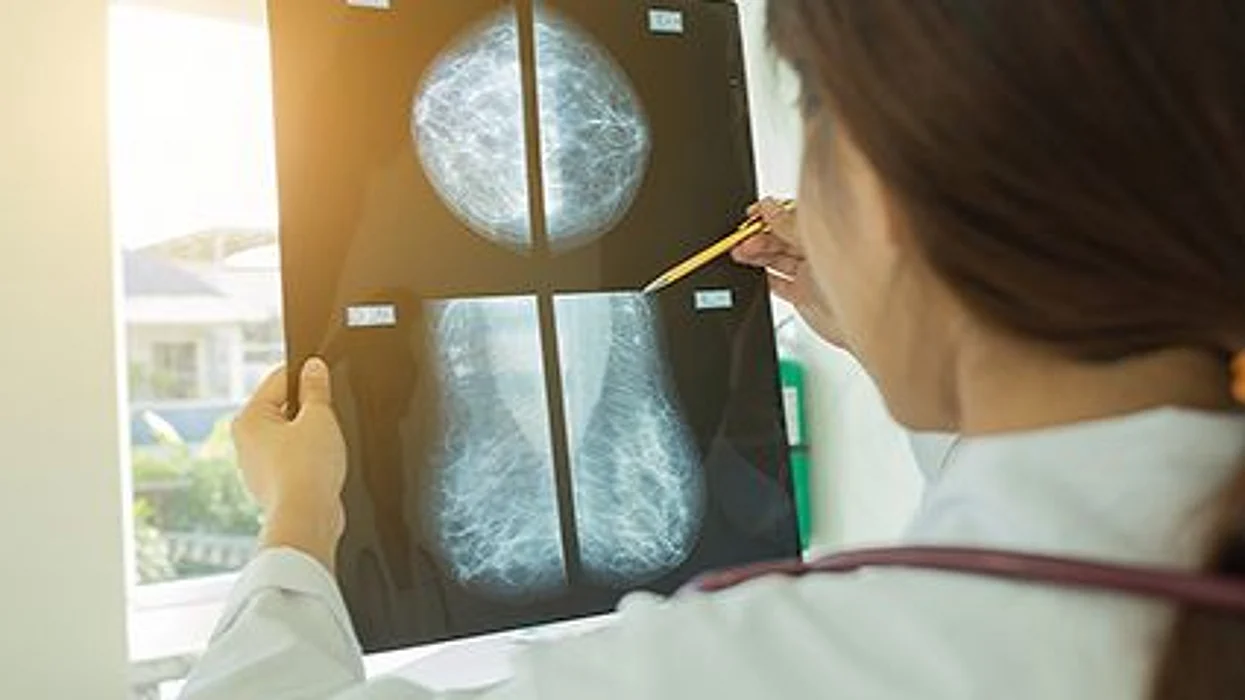 mammography