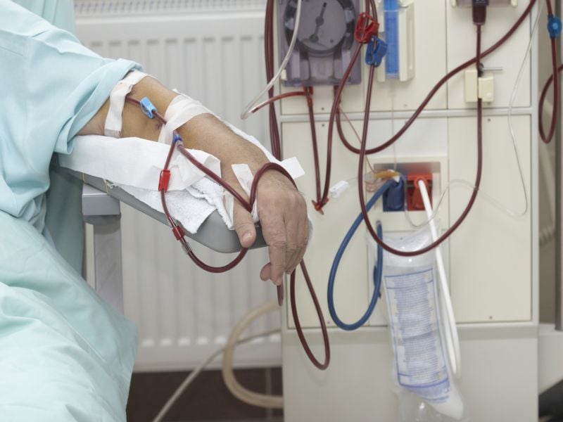 Study Casts Doubt on 'Early Warning' System for Kidney Patients