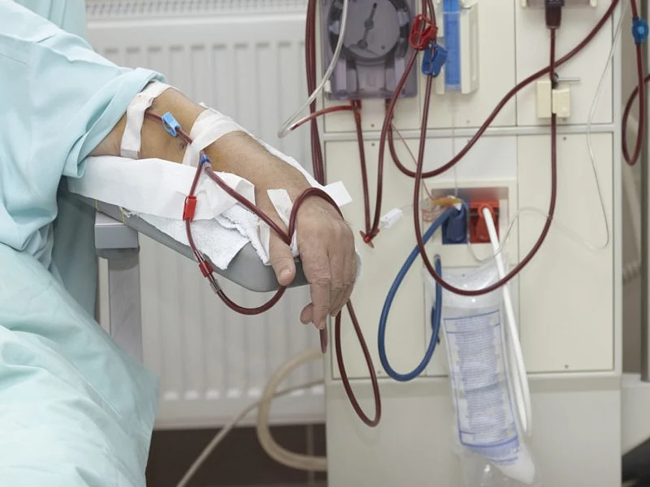 dialysis