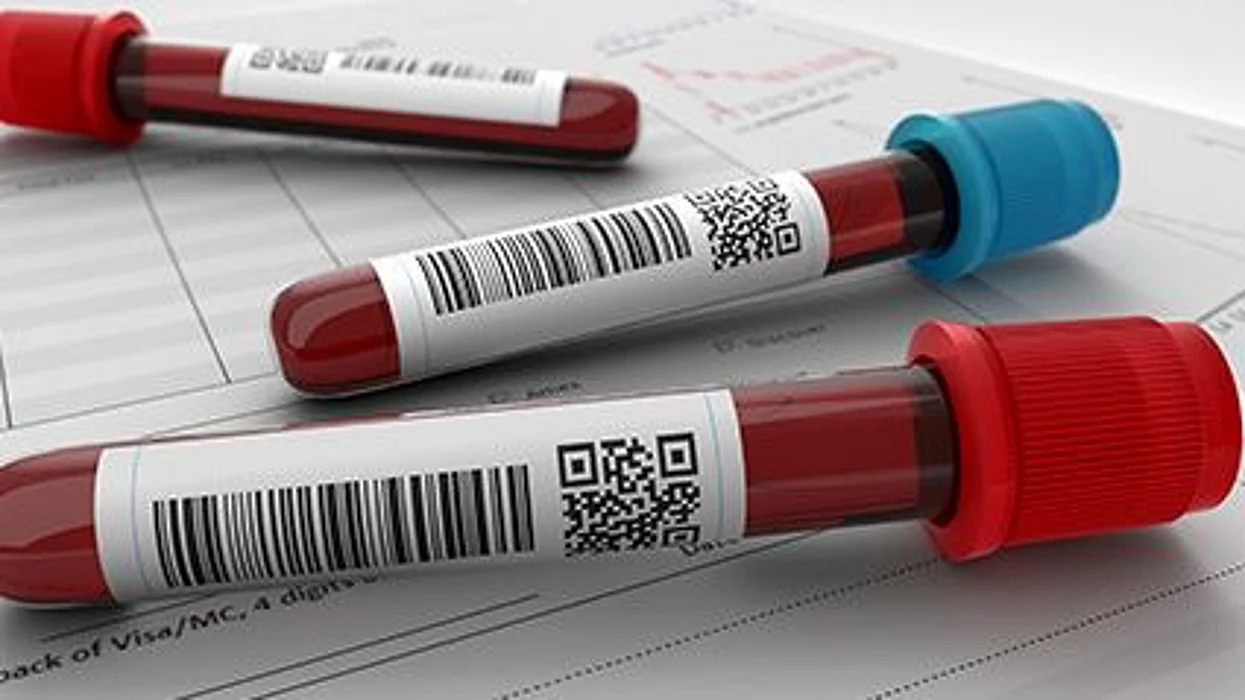 Los científicos descubren por qué el grupo sanguíneo podría ser importante en la infección con la COVID