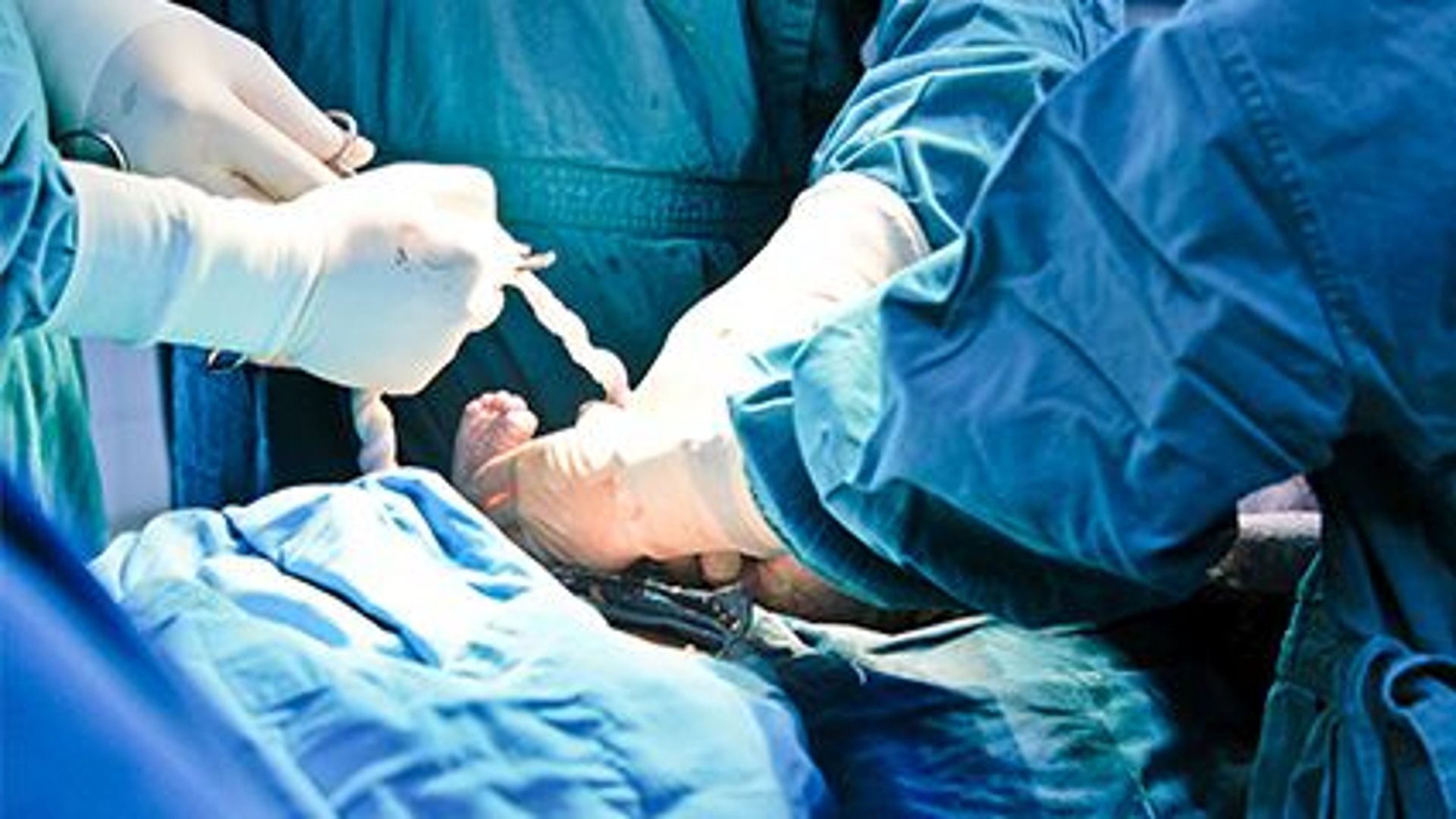 'Awareness' Under C-Section Anesthesia May Be Less Rare Than Thought thumbnail