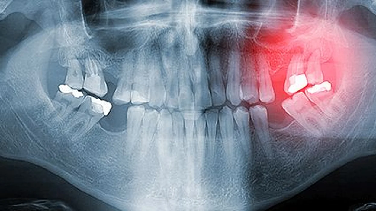 xray