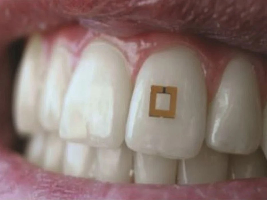 Tooth Sensor