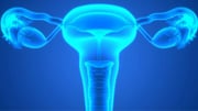 Factors Identified Tied to Resultant Oophorectomy With Ovarian Torsion