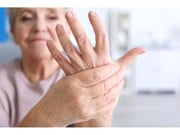 El IMC está relacionado con el dolor en pacientes con artrosis de mano