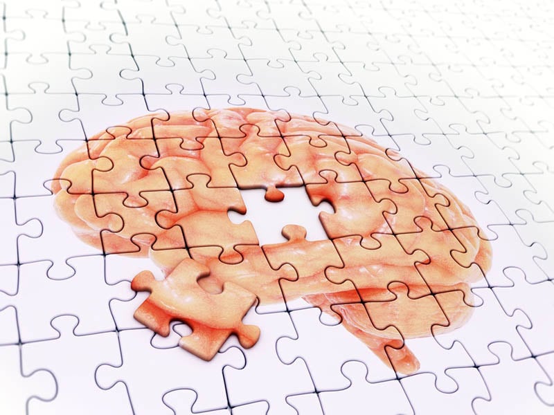 Aphasia Affects Brain Similar to Alzheimer's, But Without Memory Loss