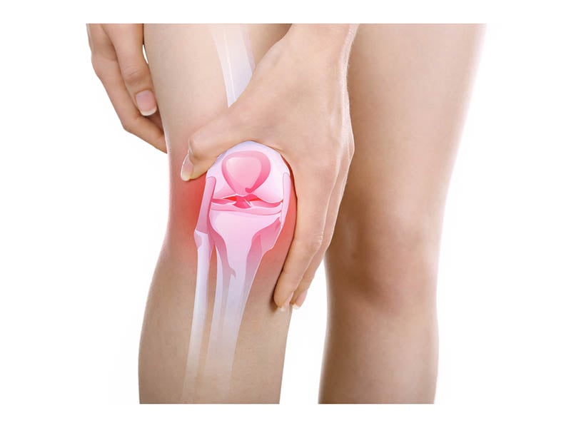A Vitamin Could Be Key to Women's Pain After Knee Replacement