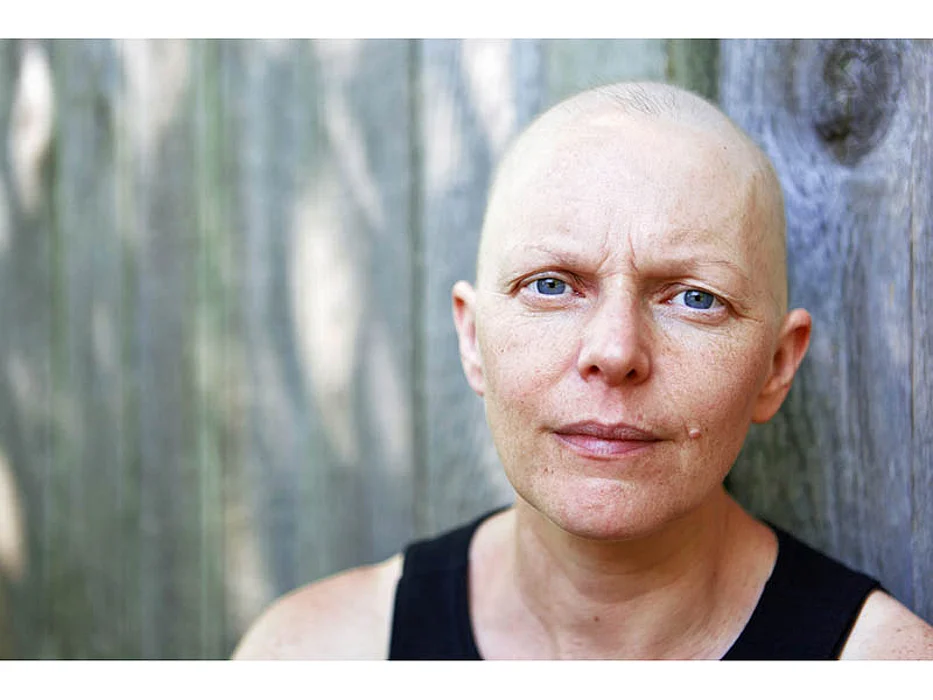 Risk for Developing, Dying From Second Cancer Higher for Survivors