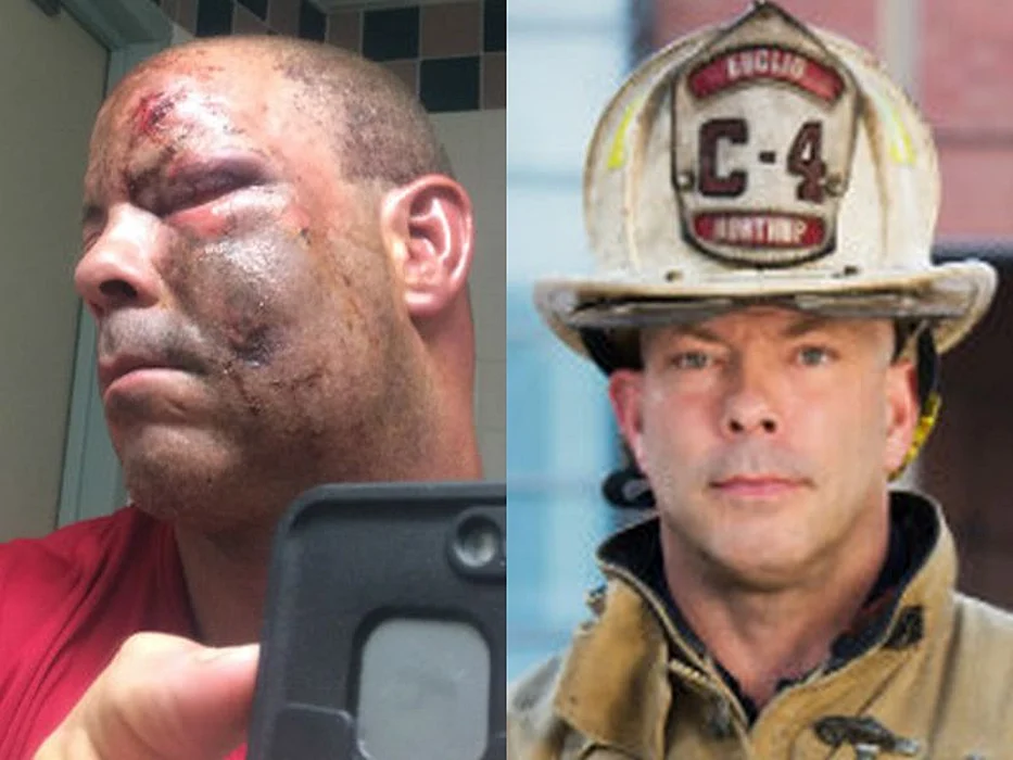 Fireman Jay Northup\'s injuries, and today