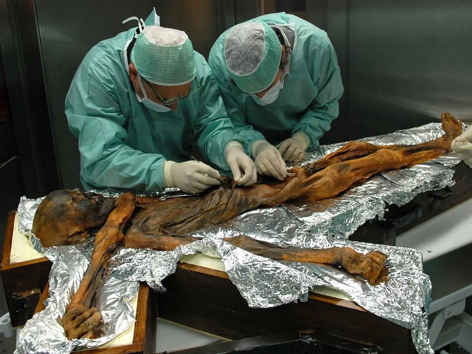 Iceman stomach sampling