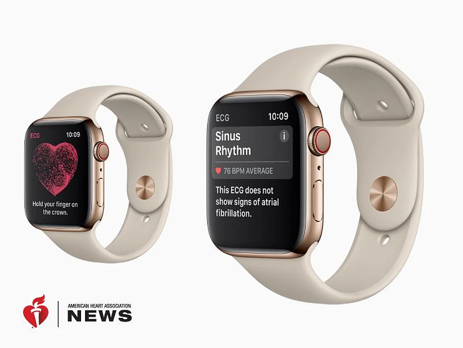 ECG on Apple Watch
