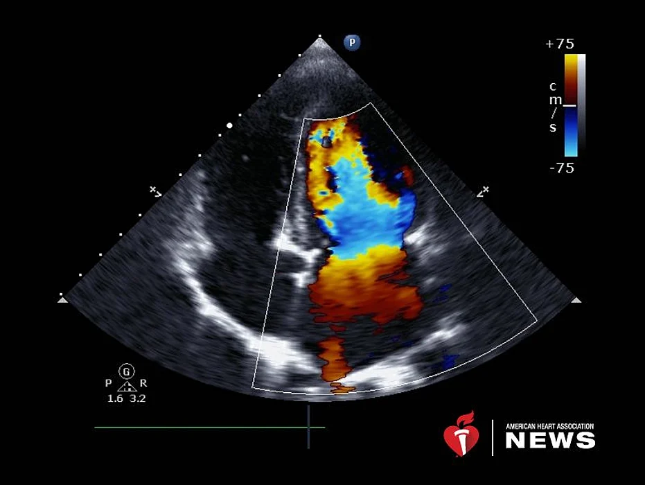 new technology for echocardiograms