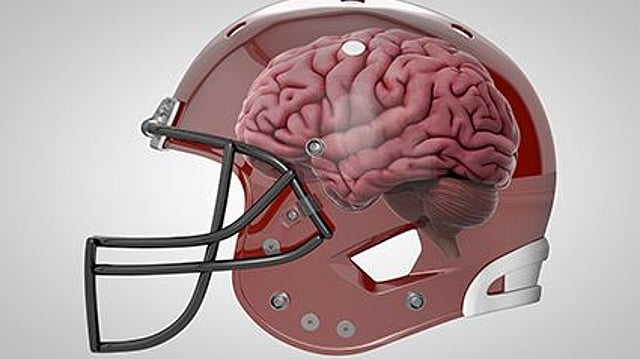 Football And Head Trauma Consumer Health News HealthDay