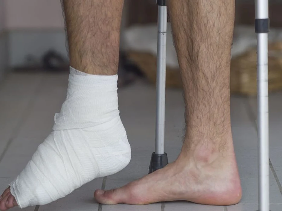 broken ankle in cast