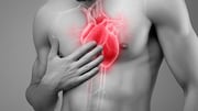 Immune Checkpoint Inhibitor Therapy Tied to Cardiac Event Risk