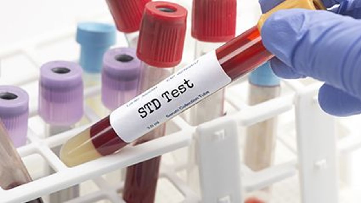 U.S. STD Cases Spiked During Pandemic