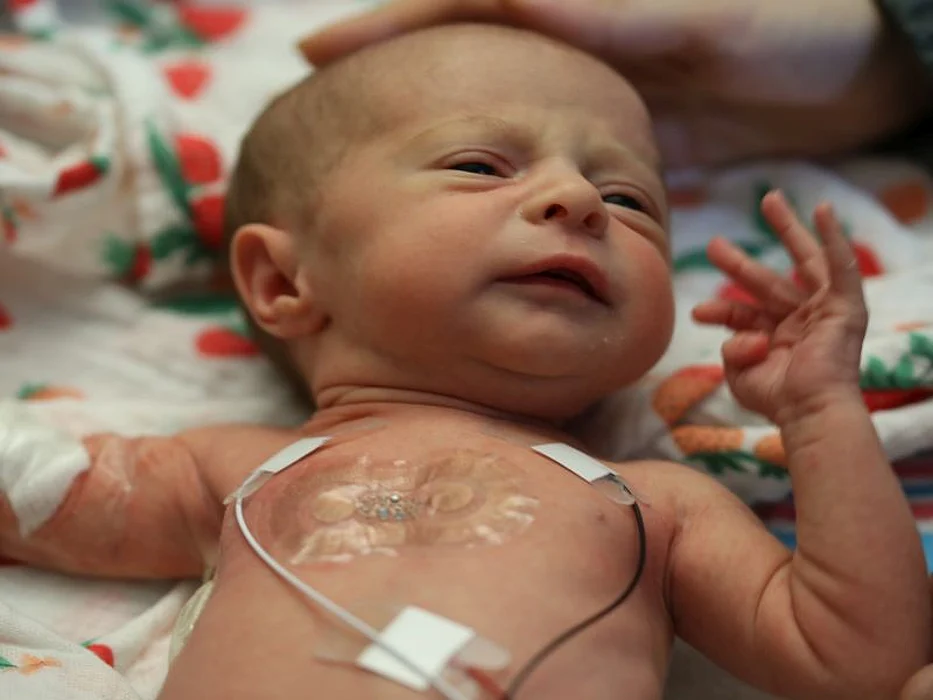 Lightweight sensor on baby