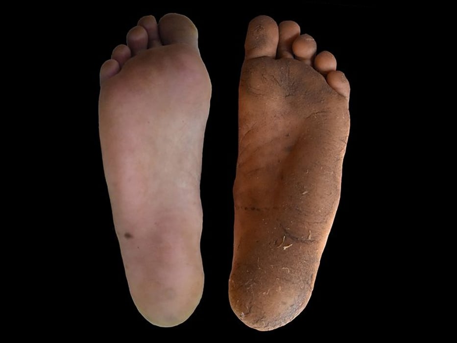 Shoe-wearing (left) vs. regularly barefoot sole. Photo: D. Lieberman