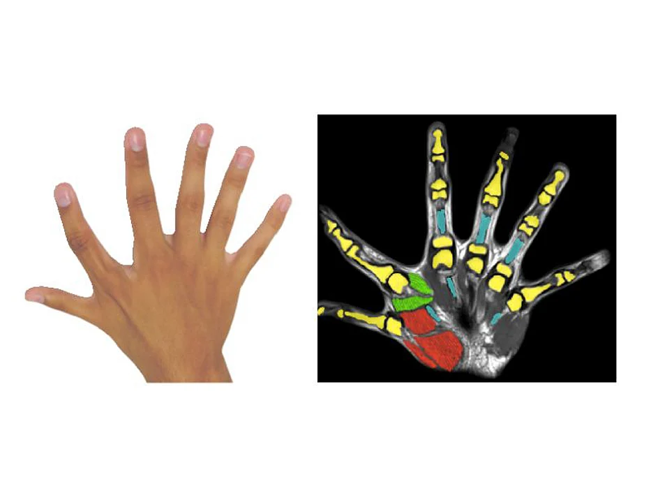six fingers