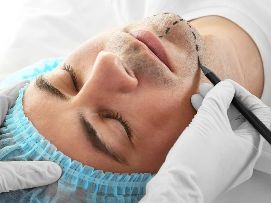 man having plastic surgery