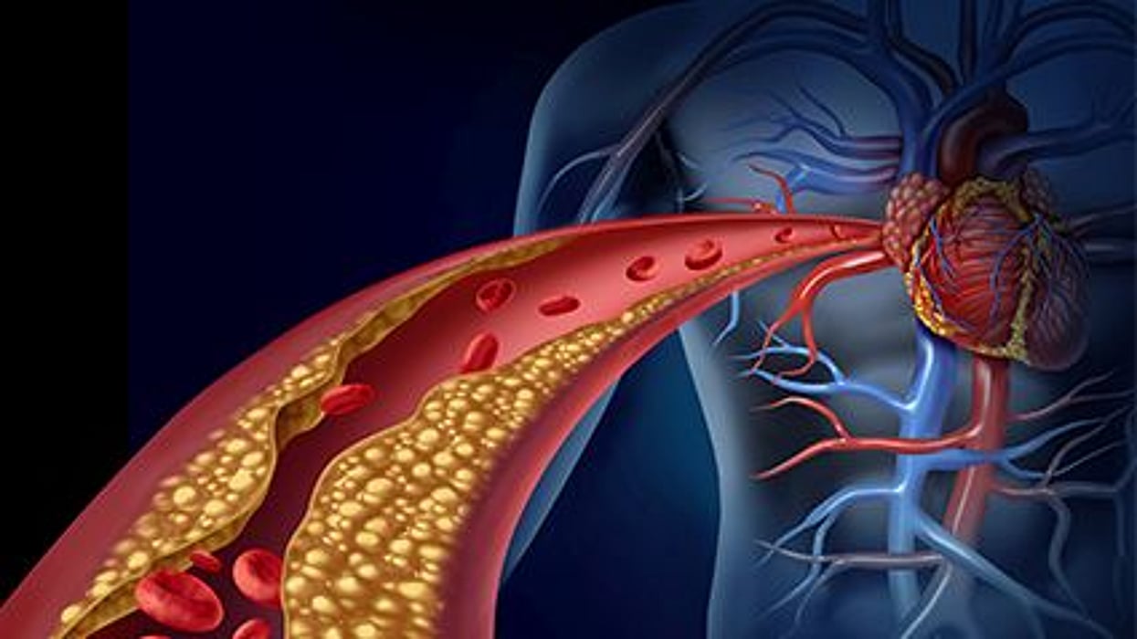 a diagram of a arteries