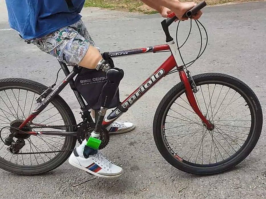 New Prosthetic Leg Can Feel Touch, Reduce 'Phantom Limb' Pain