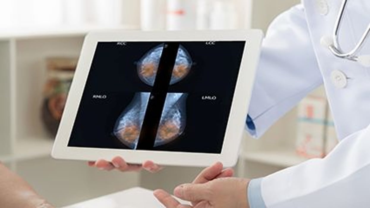 mammography images