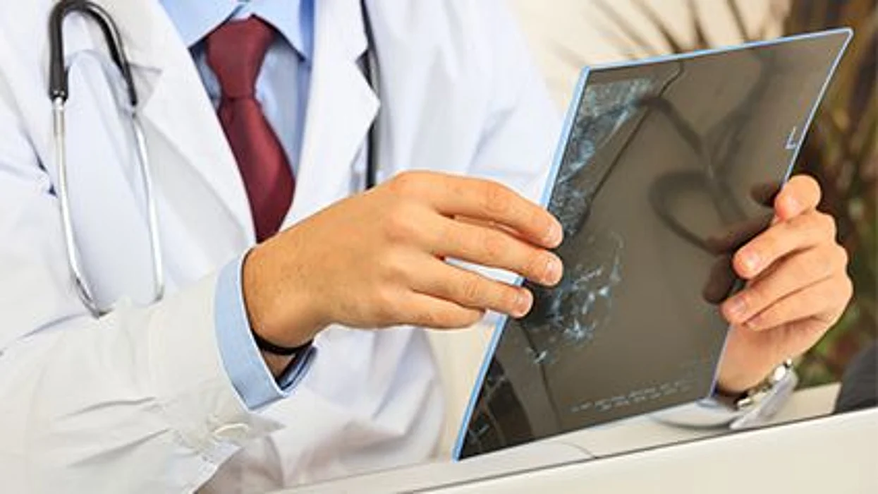 a doctor looking at the x-ray pictures