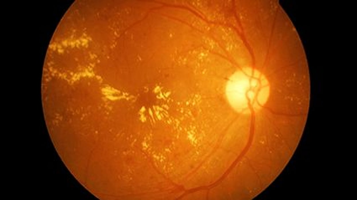 eye
